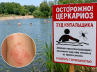 «Зуд купальщика» добрался до Краснодарского края: в России фиксируют случаи церкариоза