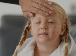 Ветрянка атакует страну: в Краснодарском крае нет вакцины?