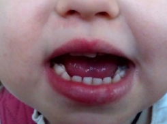 Скандал с разбитой губой в детском саду Новороссийска: правда или вымысел