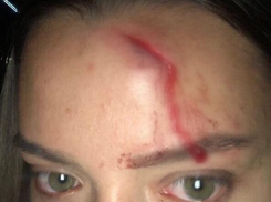 Пьяные отдыхающие разбили лоб сотруднице тира