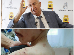 За избиение маленького Жени может ответить руководство Новороссийска