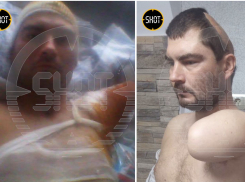 На Кубани мужчина лишился руки и части черепа из-за удара током 10 000 вольт