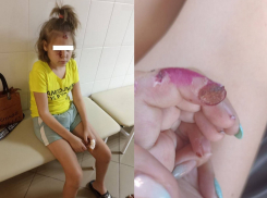13-летняя девочка вернулась избитой и изрезанной из больницы на Кубани