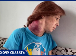 Положите меня, она растет: онкобольная жительница Новороссийска просит о помощи