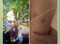 В Новороссийске девочка укусила мальчика и угрожала ножом