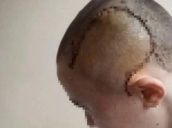 Отек мозга, закрытая черепно-мозговая травма: девушку нашли без сознания после поездки в такси в Новороссийске 