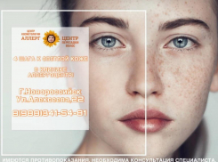 Пигментация кожи: в «АллергоЦентре» Новороссийска знают, как с этим бороться