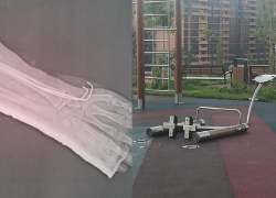 "Этот тренажер калечит детей!": на площадке в Новороссийске ребенок сломал руку