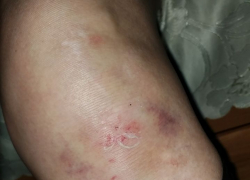 Выпавшая из маршрутки жительница Новороссийска получила серьезные травмы