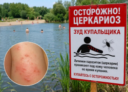 «Зуд купальщика» добрался до Краснодарского края: в России фиксируют случаи церкариоза