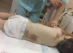 - Сигареты не тушил о падчерицу! – утверждает отчим