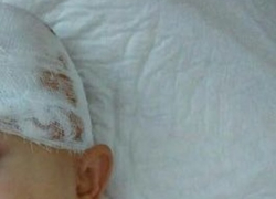 В Новороссийске мальчику пробили голову в школе