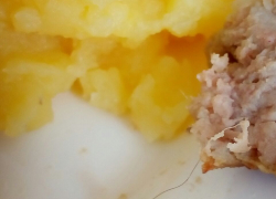 Котлеты с волосами подали на обед в новороссийской инфекционке