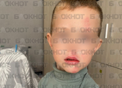 Велосипедист из Новороссийска сбил ребёнка и скрылся: мальчик получил гематомы и лишился зуба 