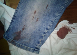 Пятеро казаков избили новороссийца по просьбе соседа