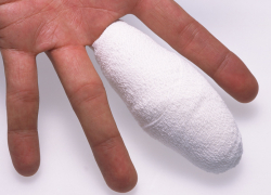 Палец на месте: стали известны подробности случившегося в детском саду Новороссийска