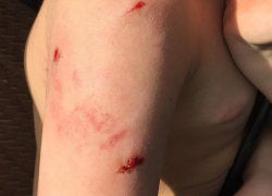 Стая собак чуть не разодрала ребенка в пригороде Новороссийска