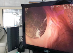 Новороссийские медики извлекли из желудка малыша пятирублевую монету