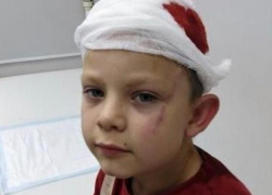 Полиция занялась делом покусанного мальчика в пригороде Новороссийска