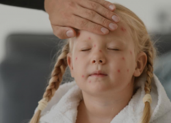 Ветрянка атакует страну: в Краснодарском крае нет вакцины?