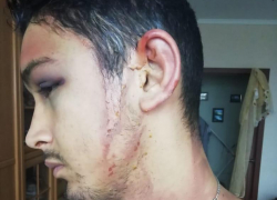 Новороссиец пошел за елкой, а попал в камеру пыток