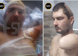 На Кубани мужчина лишился руки и части черепа из-за удара током 10 000 вольт