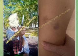 В Новороссийске девочка укусила мальчика и угрожала ножом