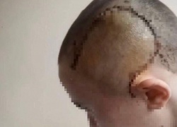 Отек мозга, закрытая черепно-мозговая травма: девушку нашли без сознания после поездки в такси в Новороссийске 