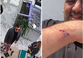 «Я думал, это шутка!»: избитый выдвиженец в депутаты Новороссийска рассказал о нападении