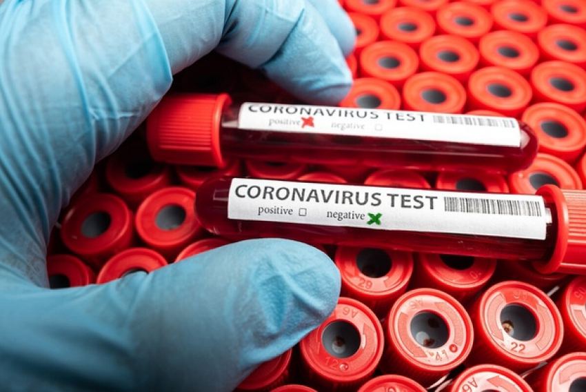 Справку на коронавирус больше не требуют в санаториях Кубани