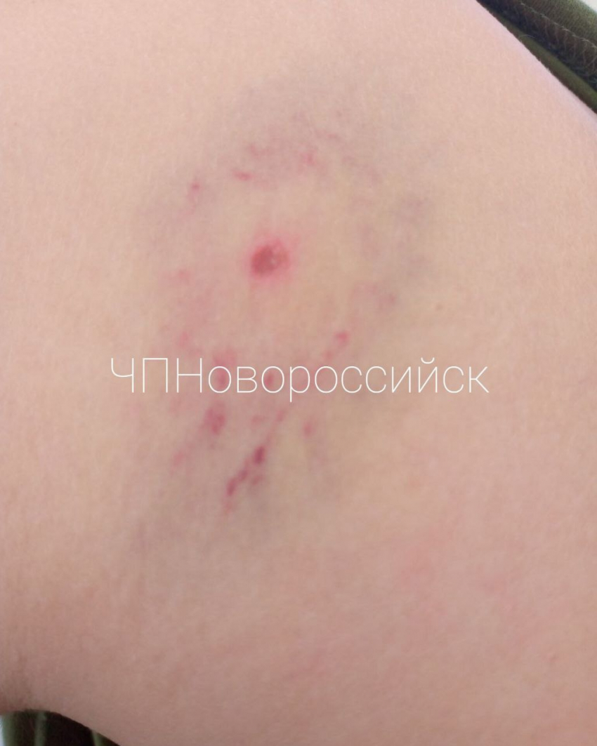 Дети против детей — в подростка стреляли из пневмата в Новороссийске