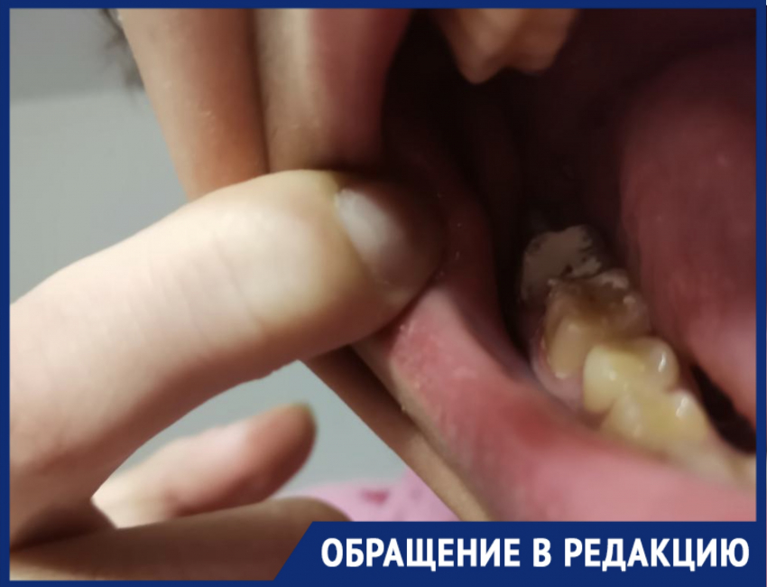 Может, тебе еще сплясать: жительница Новороссийска возмущена отношением стоматолога из местной поликлиники