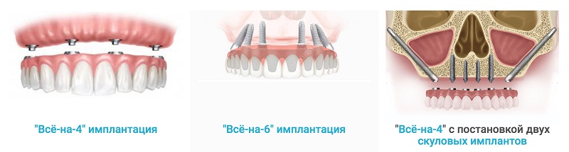 нв3.jpg